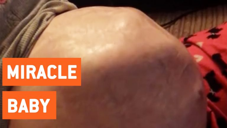 Baby draait zich om in de buik