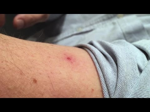 Simpele stappen om muggen buiten te houden