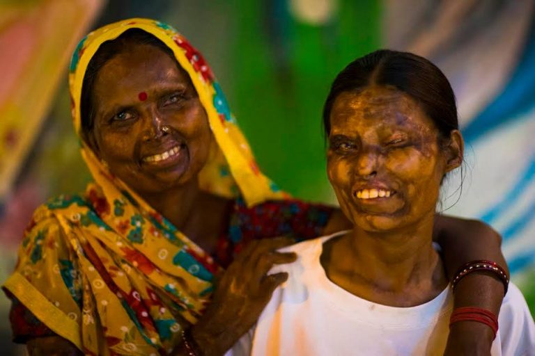 Verminkte vrouwen runnen café